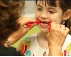 oral-placement-therapy-500x500